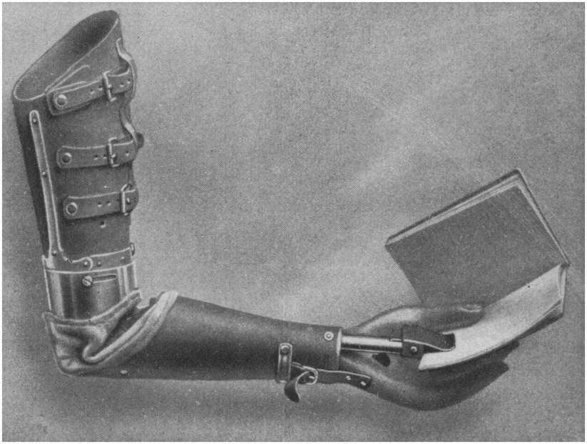 Figure 1: Artificial intelligence? From Orthopadische Behandlung Kriegsuerwundeter, 1915. 4 Mark Wigley.