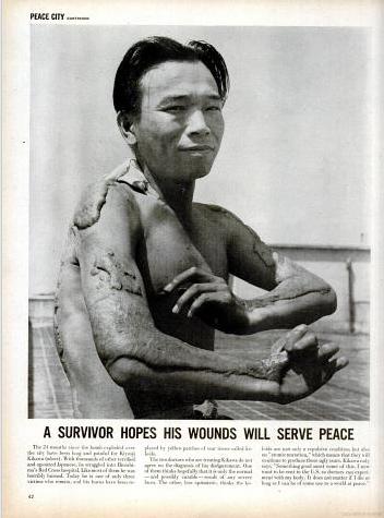 If these descriptions of suffering were unable to make Americans query the morality of its weapon, two years later, in 1947, Life magazine printed a photograph of a Hiroshima survivor, his skin badly