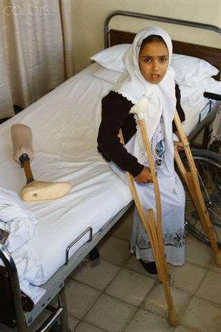ca. 1989, Jerusalem, Palestine Sabrina, a 12- year-old amputee wounded by a bullet during the